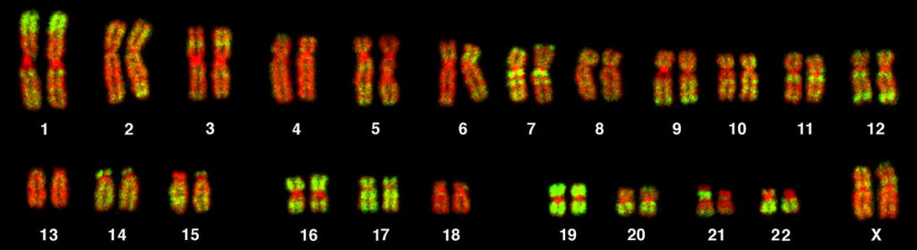 Human metaphase chromosomes